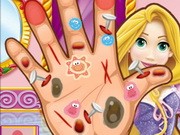 Play Rapunzel Hand Doctor Game on FOG.COM